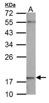 Western Blot: NDUFB5 Antibody [NBP1-31684] - 50 ug mouse brain lysate/extract 12 % SDS-PAGE gel, antibody dilution 1:1000.