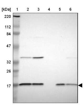 <b>Orthogonal Strategies Validation. </b>Western Blot: NDUFB5 Antibody [NBP1-85607] - Lane 1: Marker  [kDa] 220, 112, 84, 47, 32, 26, 17.  Lane 2: Human cell line RT-4.  Lane 3: Human cell line U-251MG sp.  Lane 4: Human plasma (IgG/HSA depleted).  Lane 5: Human liver tissue.  Lane 6: Human tonsil tissue