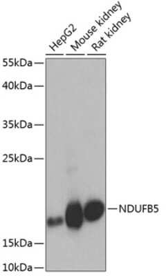 Western Blot: NDUFB5 Antibody [NBP2-95246] - Analysis of extracts of various cell lines, using NDUFB5 .Exposure time: 10s.