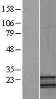 Western Blot: NDUFB5 Overexpression Lysate (Adult Normal) [NBL1-13553] Left-Empty vector transfected control cell lysate (HEK293 cell lysate); Right -Over-expression Lysate for NDUFB5.