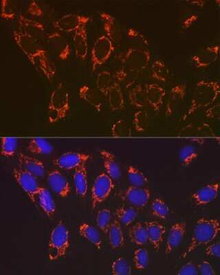 Immunocytochemistry/Immunofluorescence: NDUFB8 Antibody (6T8G1) [NBP3-15882] - Immunofluorescence analysis of U-2 OS cells using NDUFB8 Rabbit mAb (NBP3-15882) at dilution of 1:100 (40x lens). Blue: DAPI for nuclear staining.