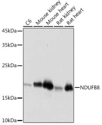 Western Blot: NDUFB8 Antibody (6T8G1) [NBP3-15882] - Western blot analysis of extracts of various cell lines, using NDUFB8 Rabbit mAb (NBP3-15882) at 1:1000 dilution. Secondary antibody: HRP Goat Anti-Rabbit IgG (H+L) at 1:10000 dilution. Lysates/proteins: 25ug per lane. Blocking buffer: 3% nonfat dry milk in TBST. Detection: ECL Basic Kit. Exposure time: 1s.