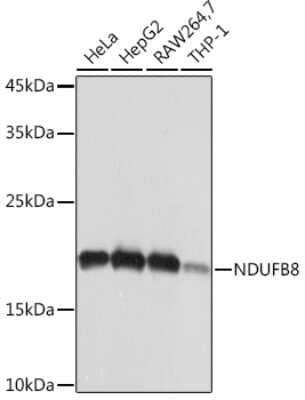 Western Blot: NDUFB8 Antibody (6T8G1) [NBP3-15882] - Western blot analysis of extracts of various cell lines, using NDUFB8 Rabbit mAb (NBP3-15882) at 1:1000 dilution. Secondary antibody: HRP Goat Anti-Rabbit IgG (H+L) at 1:10000 dilution. Lysates/proteins: 25ug per lane. Blocking buffer: 3% nonfat dry milk in TBST. Detection: ECL Basic Kit. Exposure time: 1s.