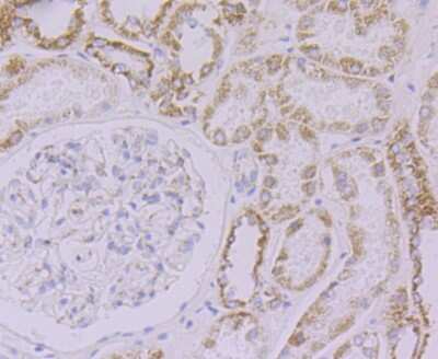 Immunohistochemistry-Paraffin: NDUFB8 Antibody (JG61-36) [NBP2-75586] - Analysis of paraffin-embedded human kidney tissue using anti-NDUFB8 antibody. Counter stained with hematoxylin.
