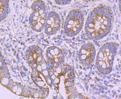 Immunohistochemistry-Paraffin: NDUFB8 Antibody (JG61-36) [NBP2-75586] - Analysis of paraffin-embedded human small intestine tissue using anti-NDUFB8 antibody. Counter stained with hematoxylin.