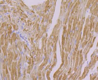 Immunohistochemistry-Paraffin: NDUFB8 Antibody (JG61-36) [NBP2-75586] - Analysis of paraffin-embedded rat heart tissue using anti-NDUFB8 antibody. Counter stained with hematoxylin.