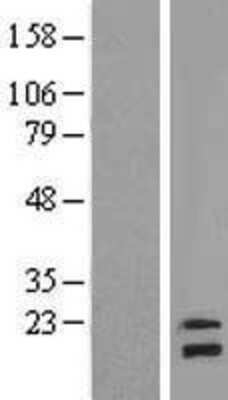 Western Blot: NDUFB8 Overexpression Lysate (Adult Normal) [NBL1-13556] Left-Empty vector transfected control cell lysate (HEK293 cell lysate); Right -Over-expression Lysate for NDUFB8.