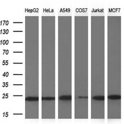 Western Blot: NDUFB9 Antibody (OTI13H11) - Azide and BSA Free [NBP2-72919] - Analysis of extracts (10ug) from 6 different cell lines by using NDUFB9 monoclonal antibody.