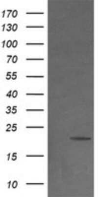 Western Blot: NDUFB9 Antibody (OTI13H11) - Azide and BSA Free [NBP2-72919] - Analysis of HEK293T cells were transfected with the pCMV6-ENTRY control (Left lane) or pCMV6-ENTRY NDUFB9.