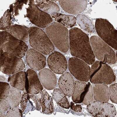 Immunohistochemistry-Paraffin NDUFC1 Antibody - BSA Free
