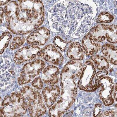 Immunohistochemistry: NDUFC2 Antibody [NBP1-88934] - Staining of human kidney shows strong cytoplasmic positivity in cells of tubules.