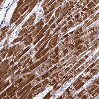 Immunohistochemistry-Paraffin: NDUFC2 Antibody [NBP2-46831] - Staining of human heart muscle shows strong cytoplasmic positivity in myocytes.