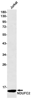 Western Blot: NDUFC2 Antibody (S05-2C2) [NBP3-19710] - Western blot detection of NDUFC2 in Jurkat cell lysates using NBP3-19710 (1:500 diluted). Predicted band size: 14kDa. Observed band size: 14kDa.