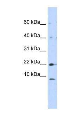 Western Blot: NDUFC2 Antibody [NBP1-59610] - 293T cells lysate, concentration 0.2-1 ug/ml.