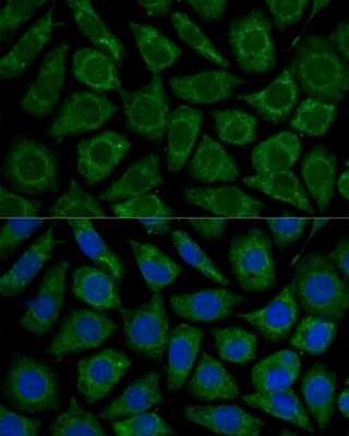 Immunocytochemistry/Immunofluorescence: NDUFS2 Antibody [NBP3-03566] - Analysis of L929 cells using NDUFS2 antibody at dilution of 1:100. Blue: DAPI for nuclear staining.