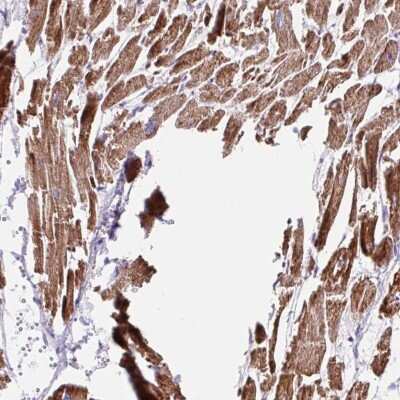 Immunohistochemistry-Paraffin: NDUFS2 Antibody [NBP2-30413] - Staining of human heart muscle shows high expression.