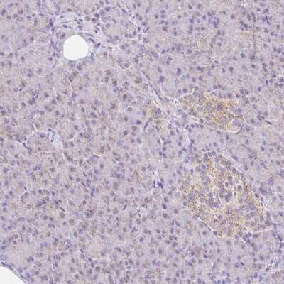 Immunohistochemistry-Paraffin: NDUFS2 Antibody [NBP2-30413] - Staining of human pancreas shows low expression as expected.