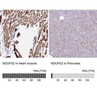 Immunohistochemistry-Paraffin: NDUFS2 Antibody [NBP2-30413] - Staining in human heart muscle and pancreas tissues using anti-NDUFS2 antibody. Corresponding NDUFS2 RNA-seq data are presented for the same tissues.