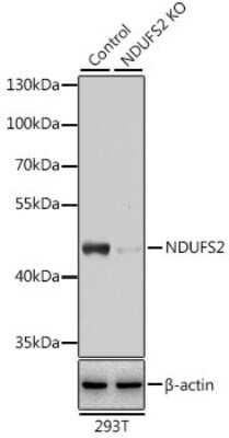 <b>Genetic Strategies Validation. </b>Knockout Validated: NDUFS2 Antibody [NBP3-03566] - Analysis of extracts from normal (control) and NDUFS2 knockout (KO) 293T cells, using NDUFS2 antibody at 1:3000 dilution. Secondary antibody: HRP Goat Anti-Rabbit IgG (H+L) at 1:10000 dilution. Lysates/proteins: 25ug per lane. Blocking buffer: 3% nonfat dry milk in TBST.