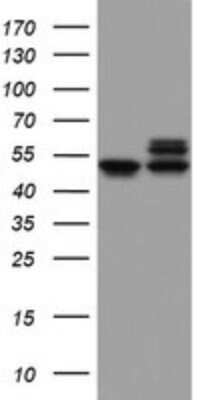 Western Blot: NDUFS2 Antibody (OTI1D5) - Azide and BSA Free [NBP2-72921] - Analysis of HEK293T cells were transfected with the pCMV6-ENTRY control (Left lane) or pCMV6-ENTRY NDUFS2.