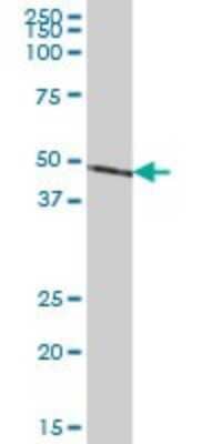 Western Blot: NDUFS2 Antibody [H00004720-B01P] - Analysis of NDUFS2 expression in human kidney.