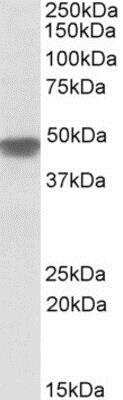 Western Blot: NDUFS2 Antibody [NBP1-52061] - (0.1ug/ml) staining of Human Heart lysate (35ug protein in RIPA buffer). Primary incubation was 1 hour. Detected by chemiluminescence.