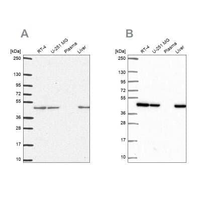 <b>Independent Antibodies Validation and Orthogonal Strategies Validation.</b>Western Blot: NDUFS2 Antibody [NBP2-30413] - Analysis using Anti-NDUFS2 antibody NBP2-30413 (A) shows similar pattern to independent antibody NBP2-49351 (B).