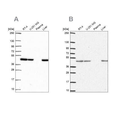 Western Blot: NDUFS2 Antibody [NBP2-49351] - Analysis using Anti-NDUFS2 antibody NBP2-49351 (A) shows similar pattern to independent antibody NBP2-30413 (B).