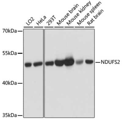 Western Blot: NDUFS2 Antibody [NBP3-03566] - Analysis of extracts of various cell lines, using NDUFS2 antibody at 1:3000 dilution. Secondary antibody: HRP Goat Anti-Rabbit IgG (H+L) at 1:10000 dilution. Lysates/proteins: 25ug per lane. Blocking buffer: 3% nonfat dry milk in TBST. Detection: ECL Basic Kit.