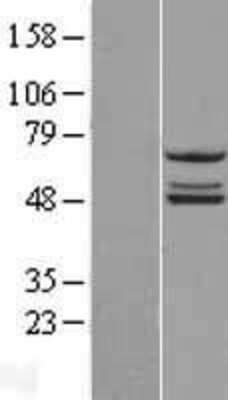 Western Blot: NDUFS2 Overexpression Lysate (Adult Normal) [NBL1-13561] Left-Empty vector transfected control cell lysate (HEK293 cell lysate); Right -Over-expression Lysate for NDUFS2.