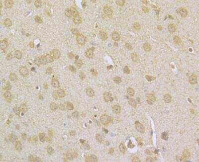 Immunohistochemistry: NDUFS3 Antibody [NBP2-76953] - Immunohistochemical analysis of paraffin-embedded mouse brain tissue using anti-NDUFS3 antibody. Counter stained with hematoxylin.