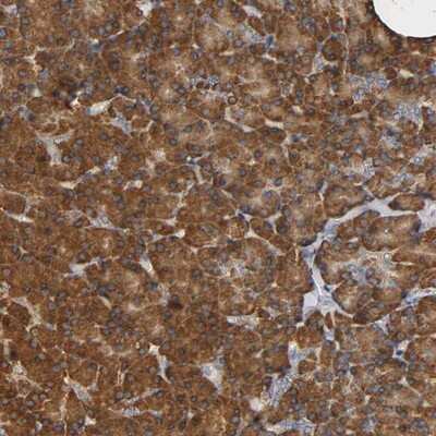 Immunohistochemistry-Paraffin: NDUFS3 Antibody [NBP1-85619] - Staining of human pancreas shows strong cytoplasmic positivity in exocrine glandular cells.