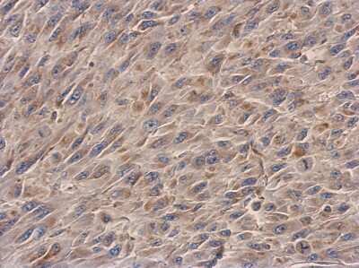 Immunohistochemistry-Paraffin: NDUFS3 Antibody [NBP2-19505] - Immunohistochemical analysis of paraffin-embedded U87 xenograft, using antibody at 1:500 dilution.