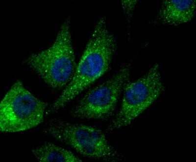 Immunocytochemistry/Immunofluorescence: NDUFS3 Antibody (JU10-32) [NBP2-75587] - Staining NDUFS3 in PC-3M cells (green). The nuclear counter stain is DAPI (blue). Cells were fixed in paraformaldehyde, permeabilised with 0.25% Triton X100/PBS.