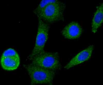 Immunocytochemistry/Immunofluorescence: NDUFS3 Antibody (JU10-32) [NBP2-75587] - Staining NDUFS3 in MCF-7 cells (green). The nuclear counter stain is DAPI (blue). Cells were fixed in paraformaldehyde, permeabilised with 0.25% Triton X100/PBS.