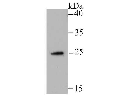 Western Blot NDUFS3 Antibody (JU10-32)