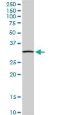 Western Blot: NDUFS3 Antibody [H00004722-D01P] - Analysis of NDUFS3 expression in human pancreas.