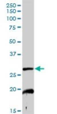 Western Blot: NDUFS3 Antibody [H00004722-D01P] - Analysis of NDUFS3 expression in mouse kidney.