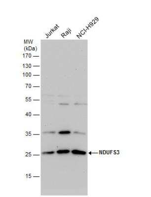<b>Genetic Strategies Validation. </b>Western Blot: NDUFS3 Antibody [NBP2-19505] - . Various whole cell extracts (30 ug) were separated by 12% SDS-PAGE, and the membrane was blotted with NDUFS3 antibody diluted by 1:1000.