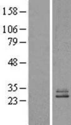 Western Blot NDUFS3 Overexpression Lysate