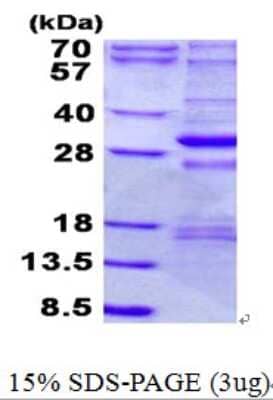 SDS-PAGE Recombinant Human NDUFS3 His Protein