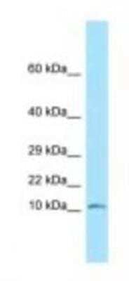 Western Blot: NDUFS6 Antibody [NBP1-98576] - Mouse Small Intestine Lysate 1.0ug/ml, Gel Concentration: 10-20%
