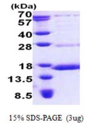 SDS-PAGE Recombinant Human NDUFS6 His Protein