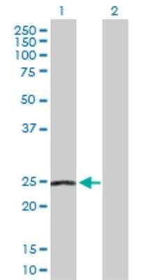 Western Blot: NDUFS8 Antibody [H00004728-D01P] - analysis of NDUFS8 expression in transfected 293T cell line by NDUFS8 MaxPab rabbit polyclonal antibody. Lane 1: NDUFS8 transfected lysate (23.70 KDa). Lane 2: Non-transfected lysate.