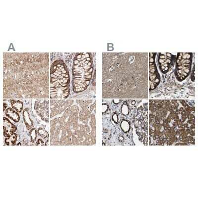 <b>Independent Antibodies Validation. </b>Immunohistochemistry-Paraffin: NDUFV3 Antibody [NBP1-85621] - Staining of human cerebral cortex, colon, kidney and liver using Anti-NDUFV3 antibody NBP1-85621 (A) shows similar protein distribution across tissues to independent antibody NBP1-85623 (B).