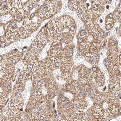 Immunohistochemistry-Paraffin: NDUFV3 Antibody [NBP1-85621] - Staining of human liver.
