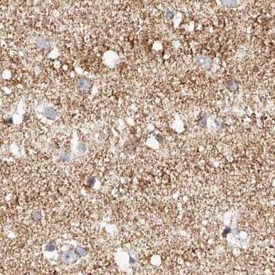 Immunohistochemistry-Paraffin: NDUFV3 Antibody [NBP1-85621] - Staining of human cerebral cortex.