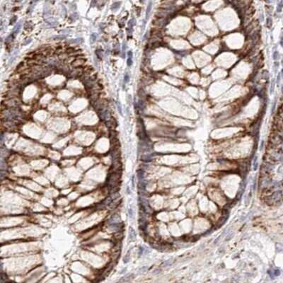 Immunohistochemistry-Paraffin: NDUFV3 Antibody [NBP1-85621] - Staining of human colon.