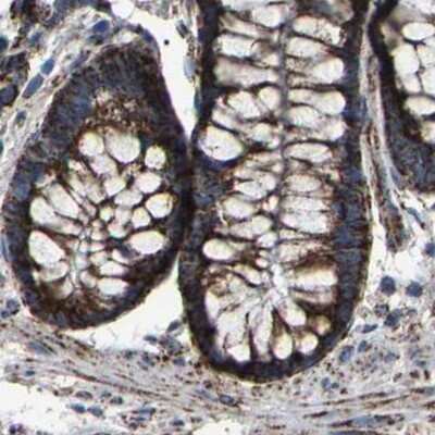 Immunohistochemistry-Paraffin: NDUFV3 Antibody [NBP1-85622] - Staining of human colon.