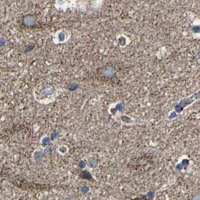 Immunohistochemistry-Paraffin: NDUFV3 Antibody [NBP1-85622] - Staining of human cerebral cortex.